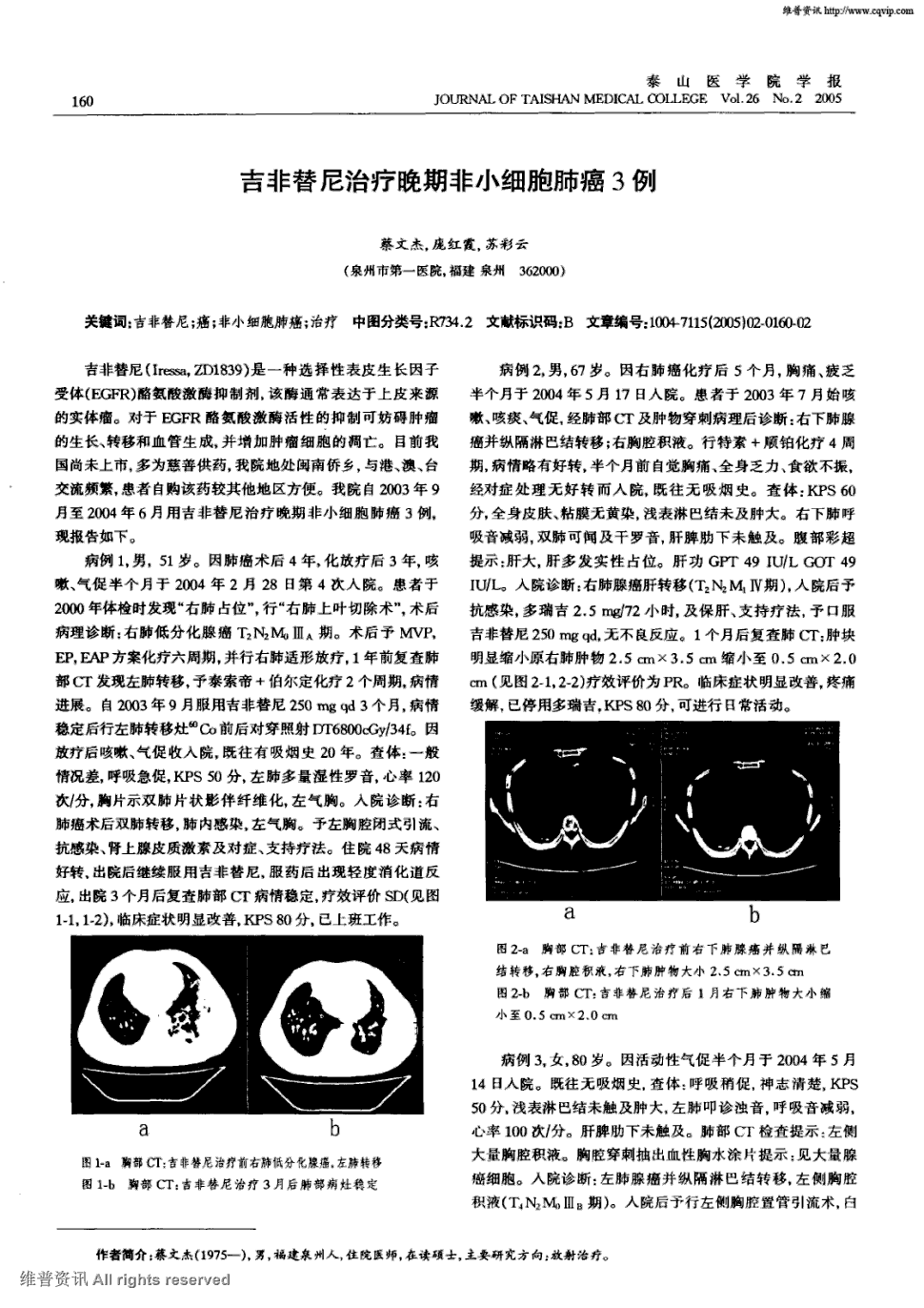 服用吉非替尼耐药后表现_克唑替尼多久出现耐药_克唑替尼5年没耐药