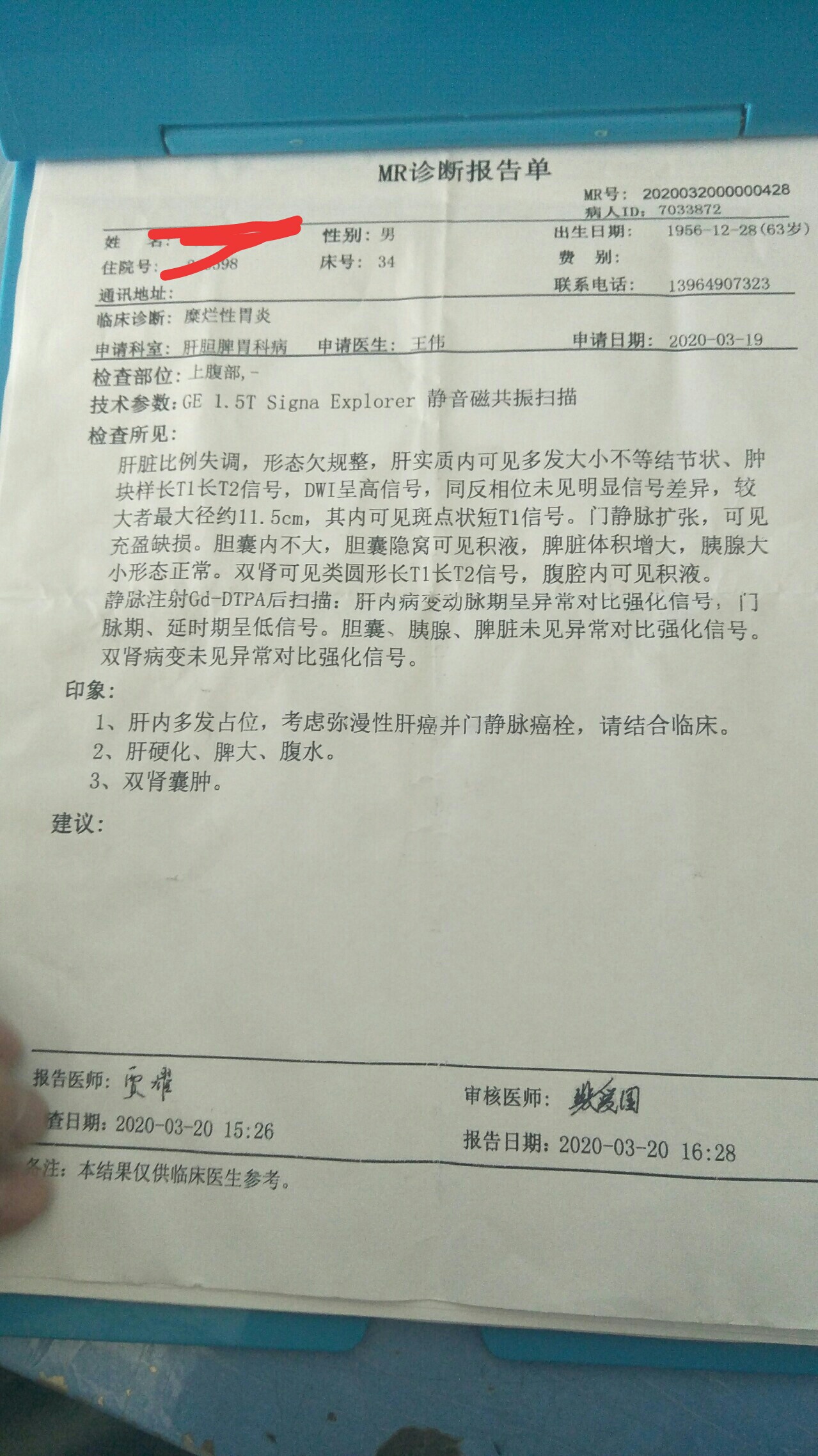 肝癌患者的生存期延长57%的治疗方法有哪些？