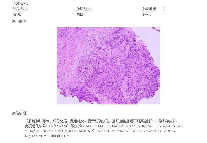 贝伐单抗突变型_贝伐单抗-阿瓦斯汀大陆卖多少钱?_贝伐单抗印度版