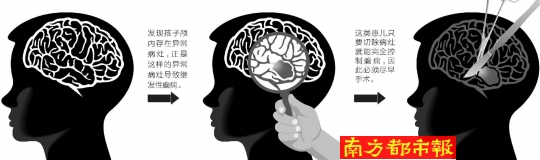 奥希替尼可以防止脑转移吗_去哪买印度版奥希替尼_进口奥希替尼