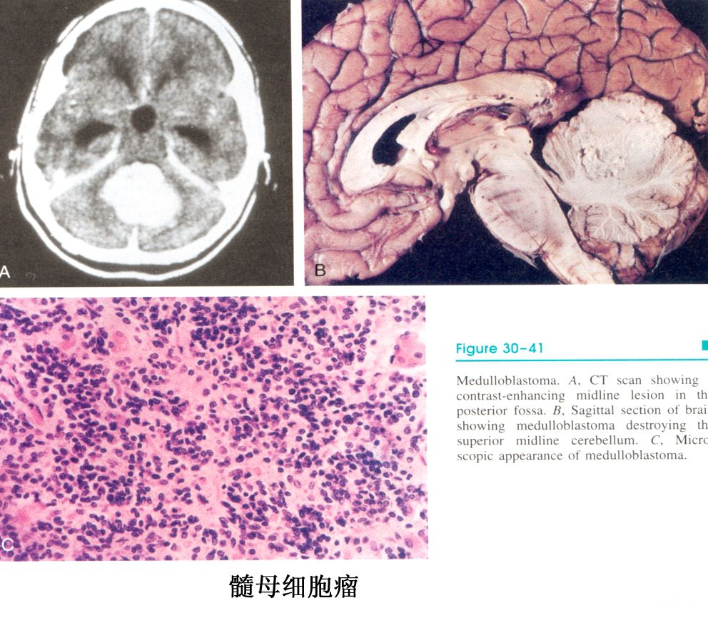靶向药奥希替尼多久耐药_靶向药凯美纳多久耐药_靶向药耐药后生存期