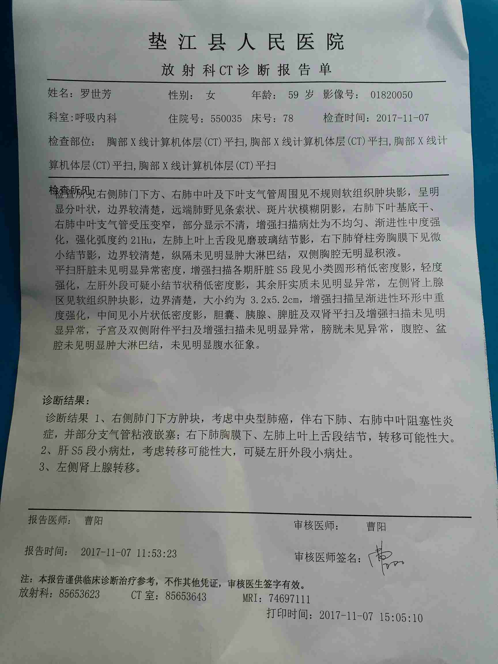 azd 9291 奥希替尼_9291奥希替尼价格_奥希替尼治骨转移