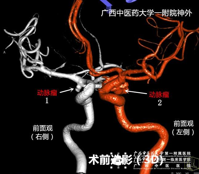 美国西北纪念医院神经肿瘤专家Dr.完成住院医师专科培训