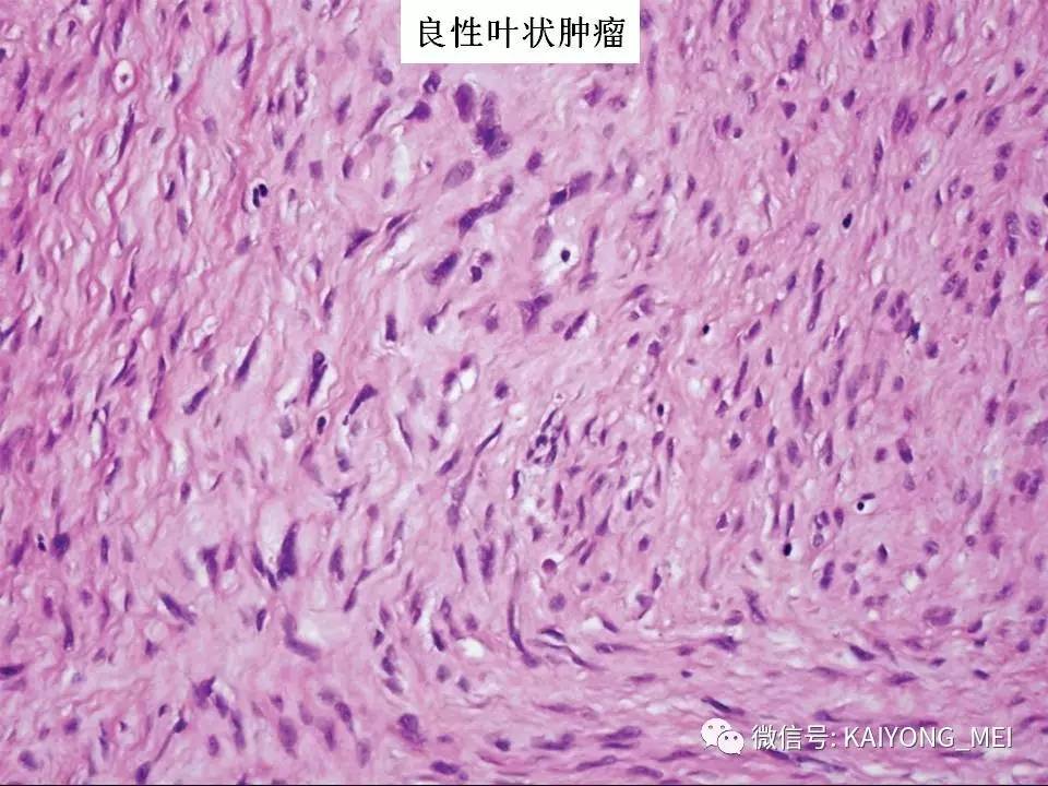 索拉非尼结构_索拉非尼与硬纤维瘤_索拉非尼价格