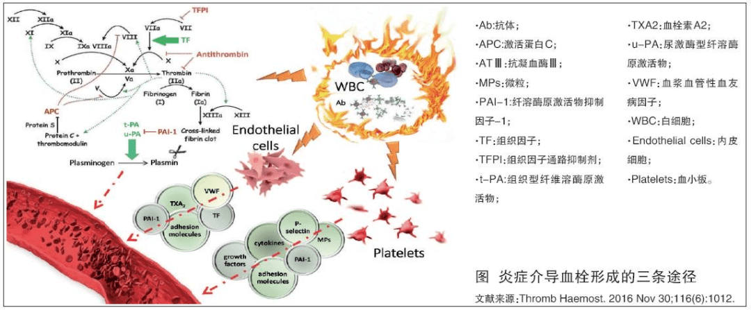 信迪利单抗+贝伐单抗治疗EGFR突变非小细胞肺癌患者有效！