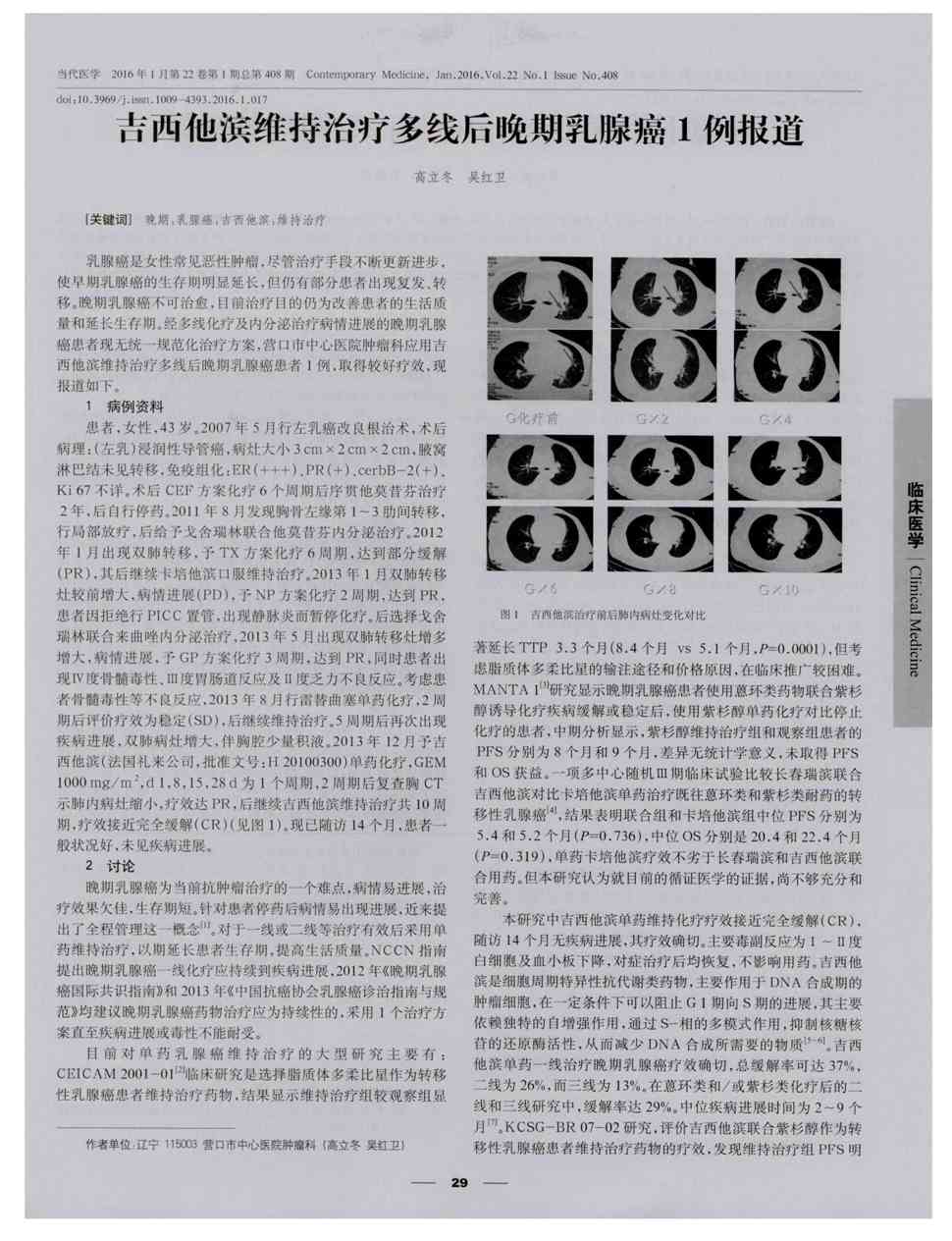 贝伐珠单抗多少钱一支_贝伐珠单抗注射液_术后卡培他滨联合贝伐单抗