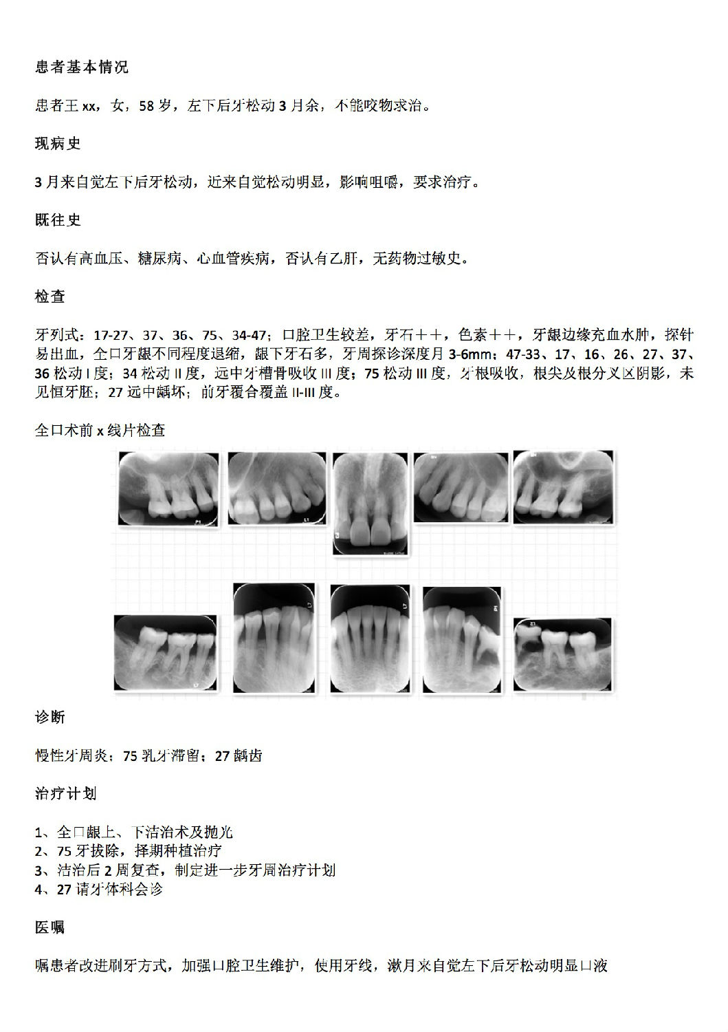 贝伐珠单抗多少钱一支_术后卡培他滨联合贝伐单抗_贝伐珠单抗注射液