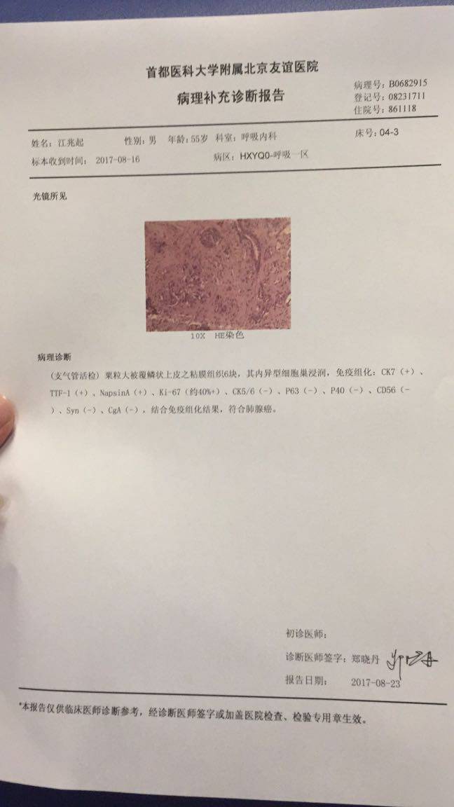 肺癌用什么靶向药_肺癌靶向药吉非替尼社保报销吗_肺癌靶向药物的价格