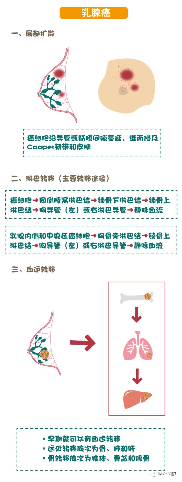 贝伐珠单抗的副作用几天后消失_贝伐珠单抗多少钱一支_贝伐珠单抗