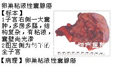 贝伐珠单抗子宫癌_贝伐珠单抗注射液_贝伐珠单抗不良反应