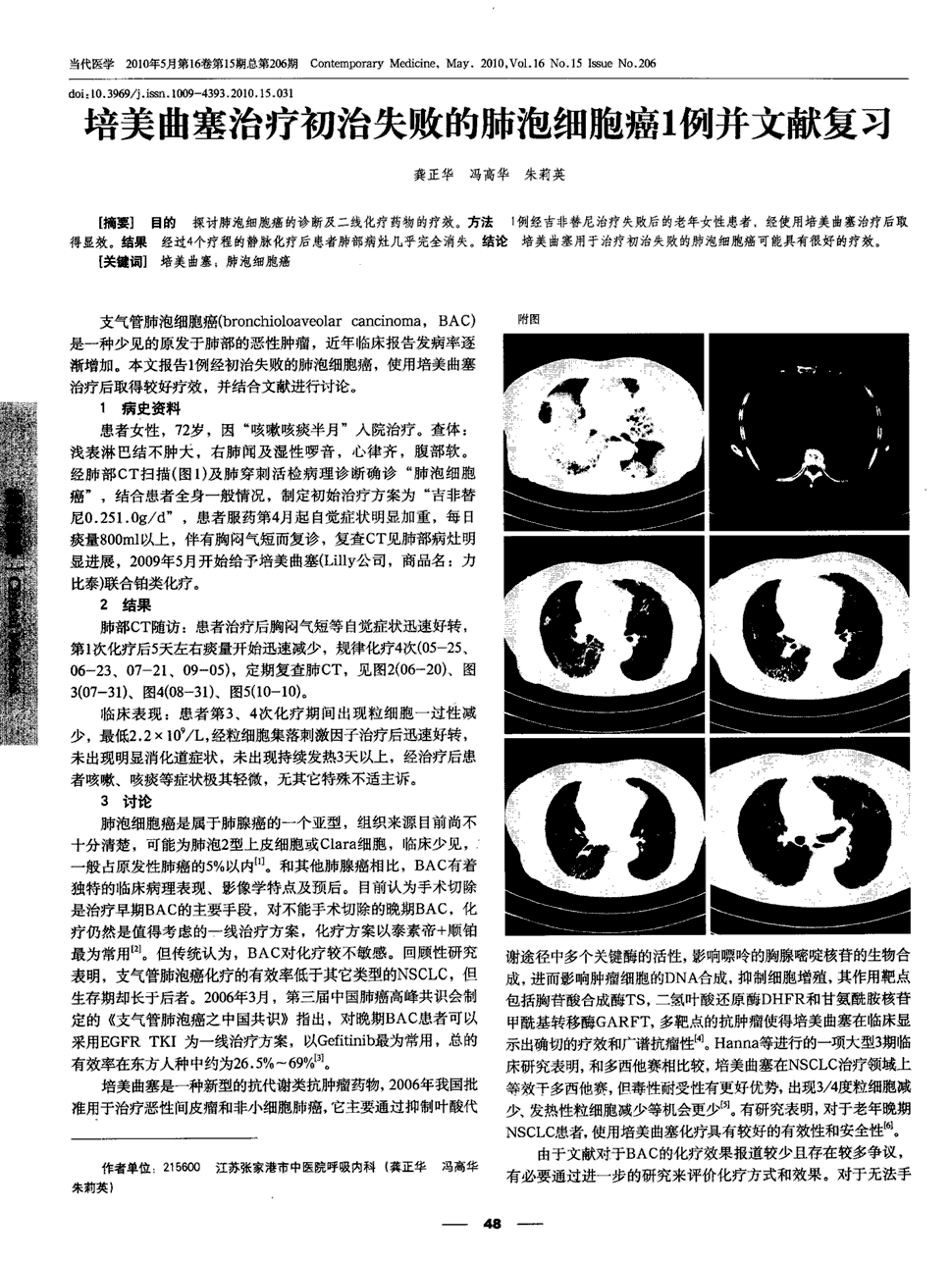 EGFR-TKIs一线治疗EGFR突变的晚期患者中位无进展