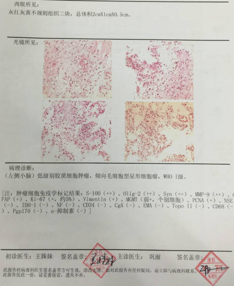 贝伐珠单抗价格_结肠癌晚期用贝伐单抗治好_贝伐单抗用多久耐药