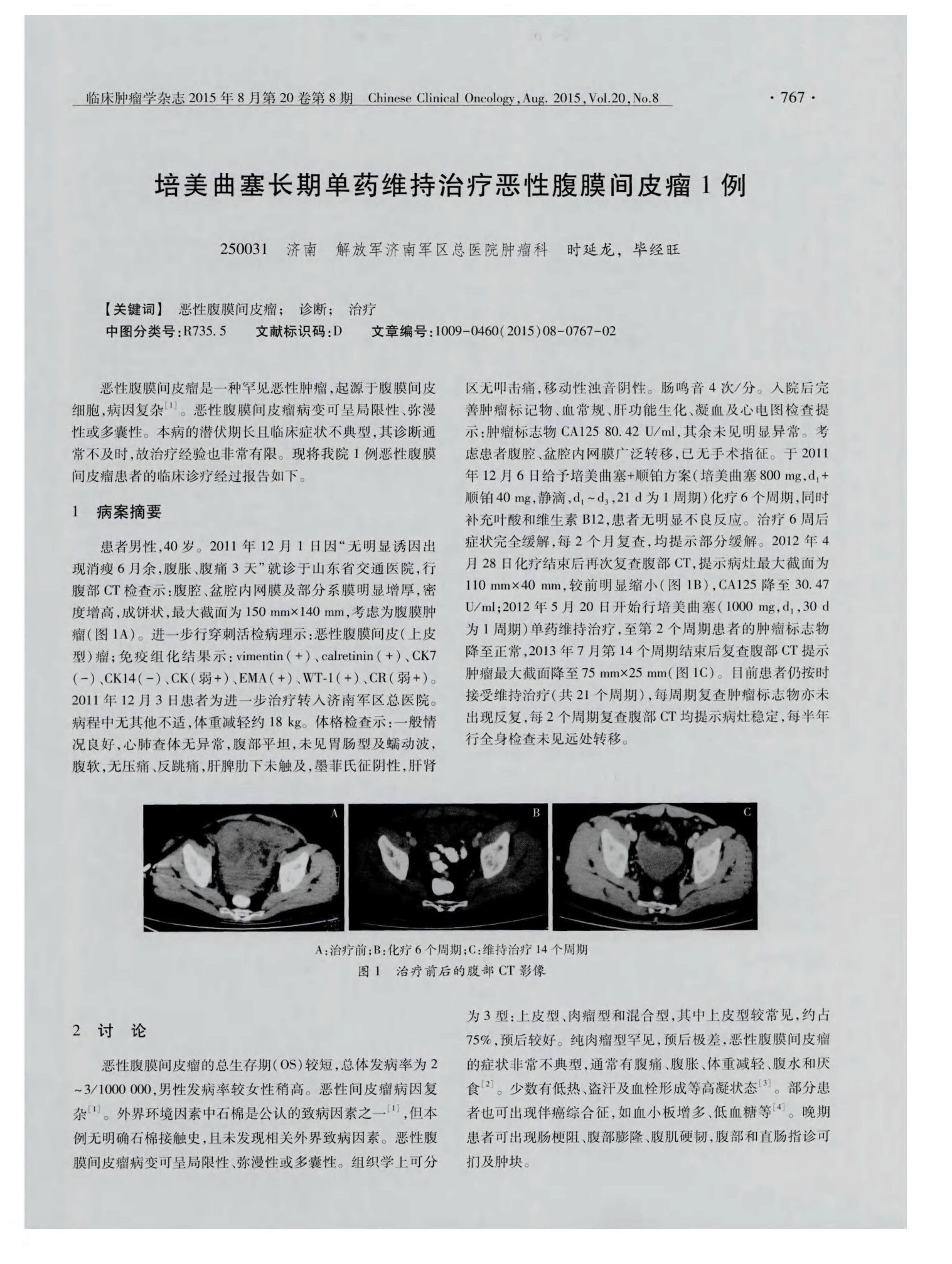 贝伐珠单抗_贝伐珠单抗是化疗药吗_贝伐珠单抗治疗疗程