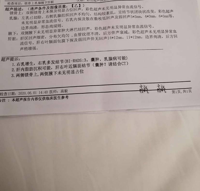 肝部穿刺活检治疗胆管细胞癌浸润胰腺、盆腔骨右侧都有转移