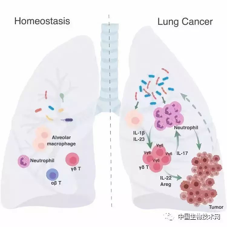 非小细胞肺癌PDX耐药PDX模型的步骤及步骤（一）