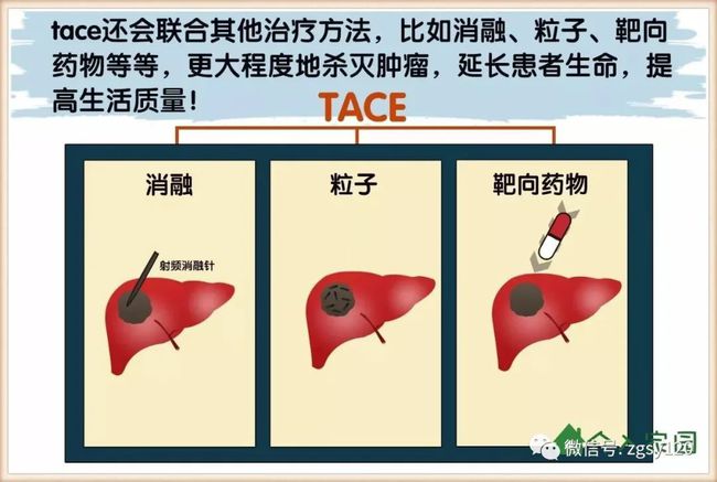 肝癌晚期如何服用索拉非尼？尼的副作用及管理？