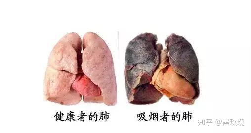 吉非替尼对晚期肺腺癌的疗效及生存期好吗？