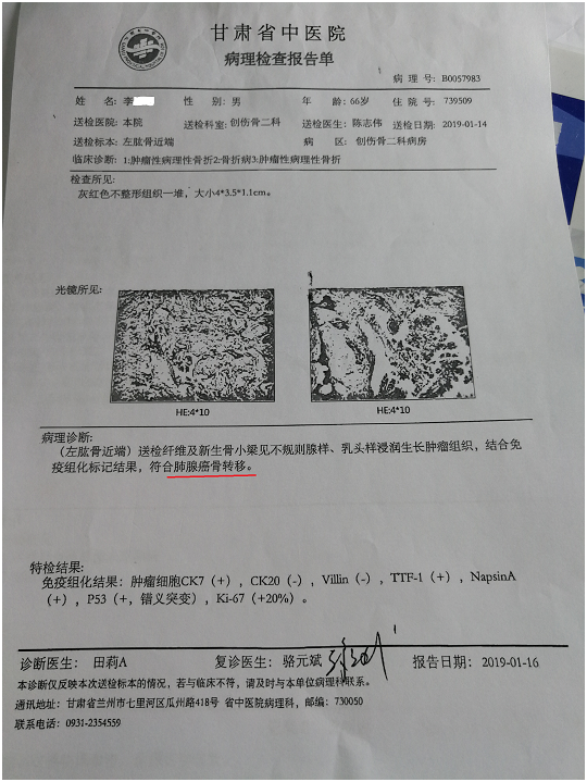 奥希替尼都有哪里产的_9291奥希替尼价格_肺癌脑转奥希替尼