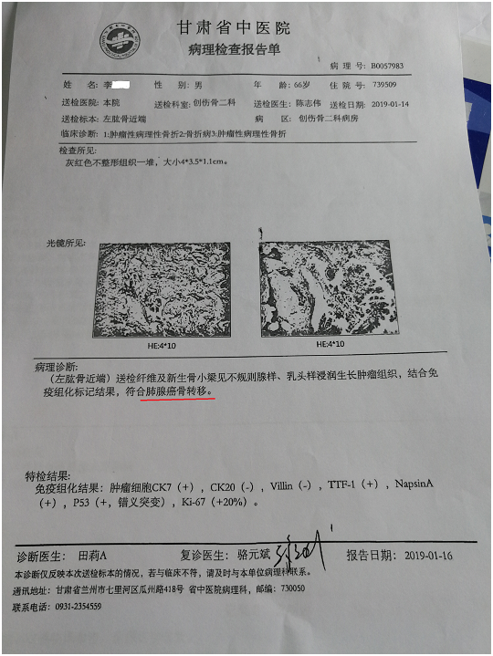 食品药品正式批准第三代肺癌靶向药物治疗EGFR突变阳性
