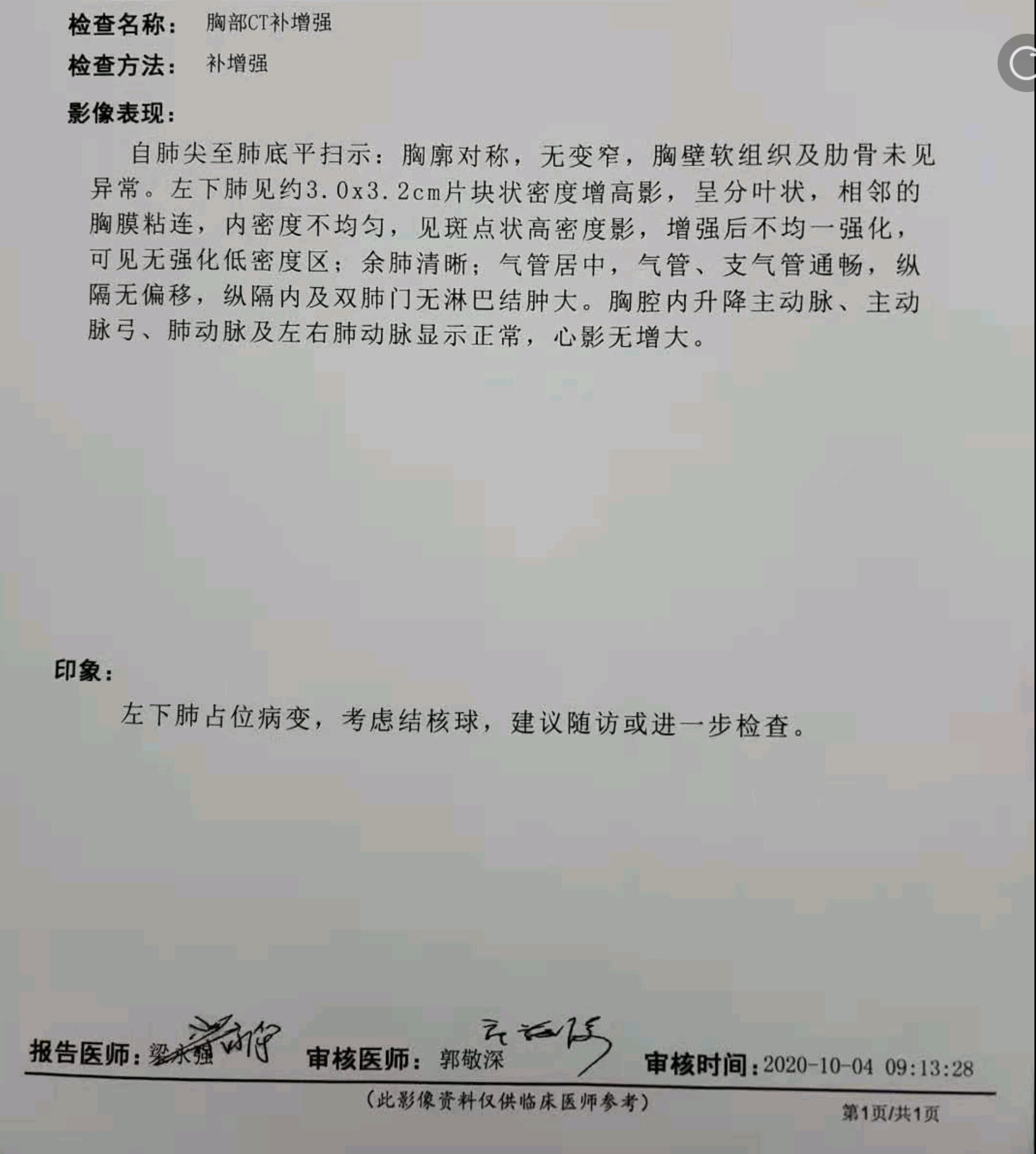 谭黎杰：早期肺癌综合治疗如何“融合”？