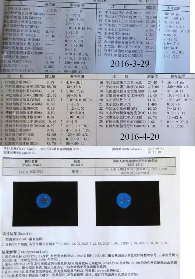 癌症就是曾经那般恐怖，现在的白血病根本不似曾经恐怖