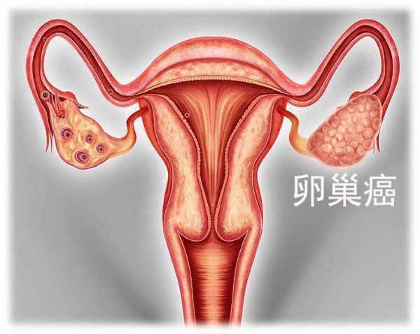 西妥昔单抗贝伐单抗_卵巢癌首次化疗贝伐单抗_贝伐珠单抗多少钱一支