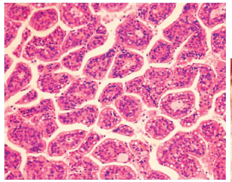 肝癌项目名称：-L1阳性晚期肝细胞癌受试者的有效性与安全性的多中心