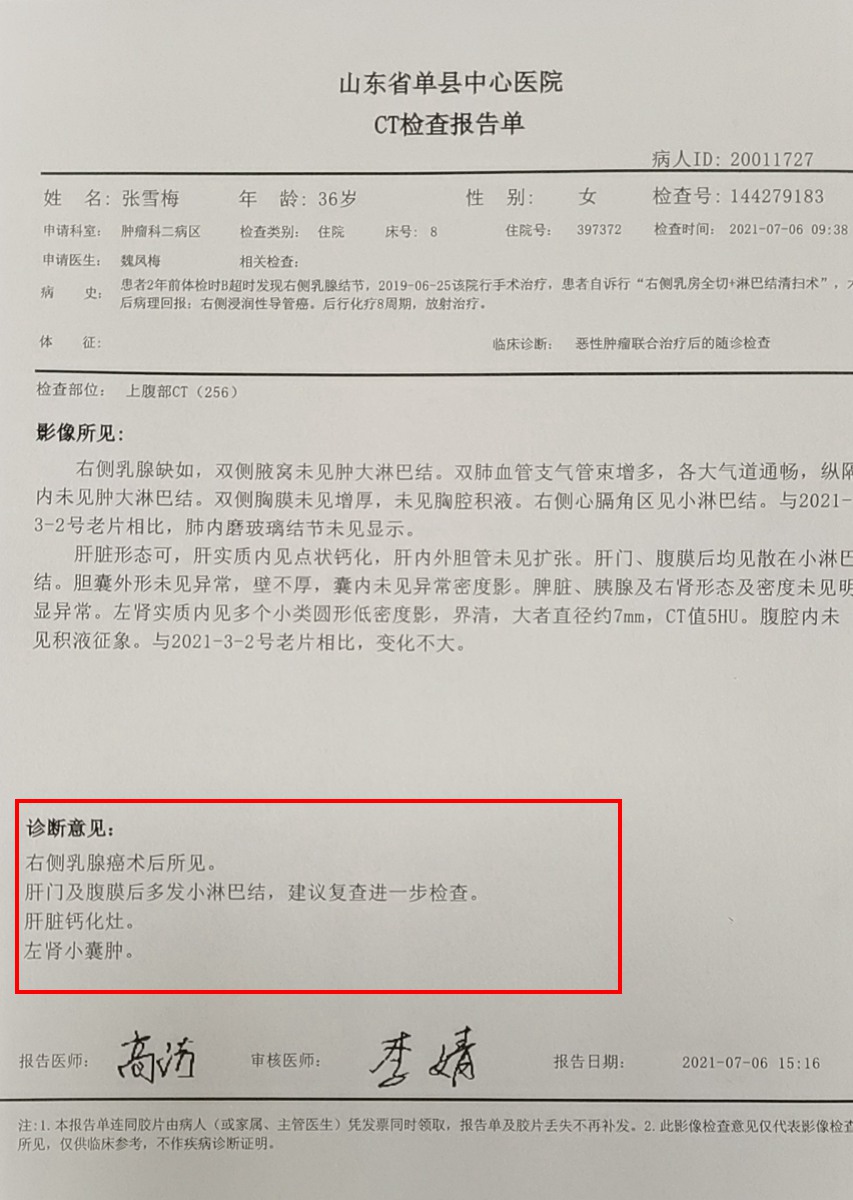 乳腺原位导管内癌_吉非替尼乳腺癌_乳腺钙化是癌吗