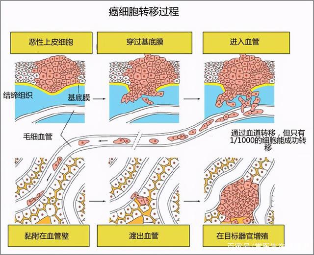 贝伐珠单抗注射液_有炎症能用贝伐单抗吗_贝伐单抗对肺癌有用吗