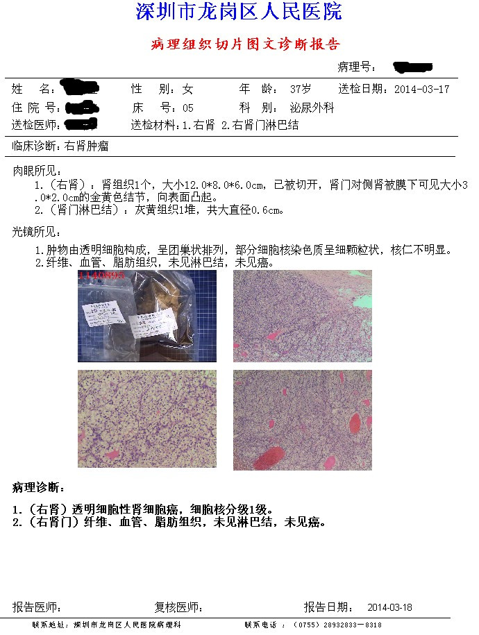 
下能使用靶向药物，采用何种副作用、以及大致治疗成本