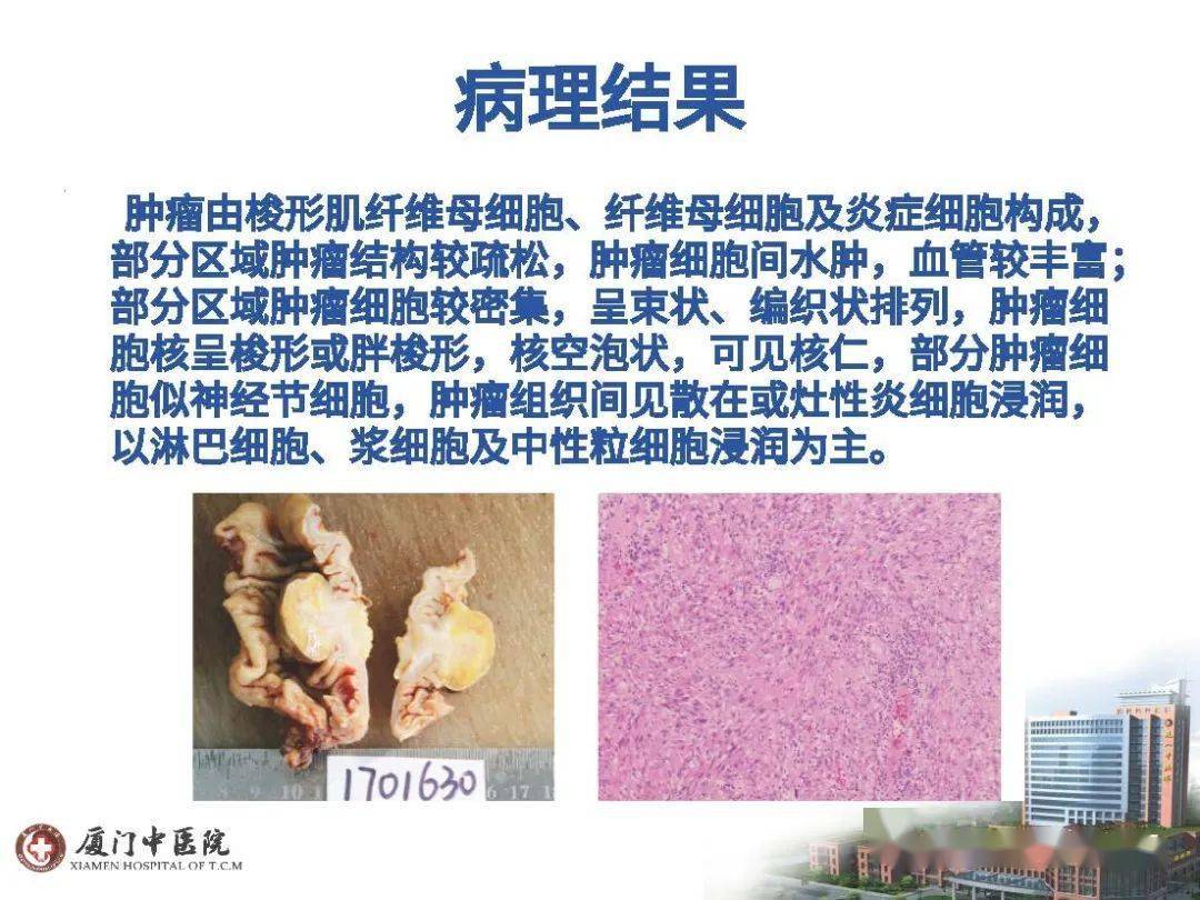 绿叶贝伐珠单抗治胶质瘤的份量_贝伐珠单抗靶向是啥_贝伐珠单抗是化疗药吗