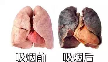 吉高由里子尼川元气_吉普希.凡尼尔马_吉非替尼服药方式