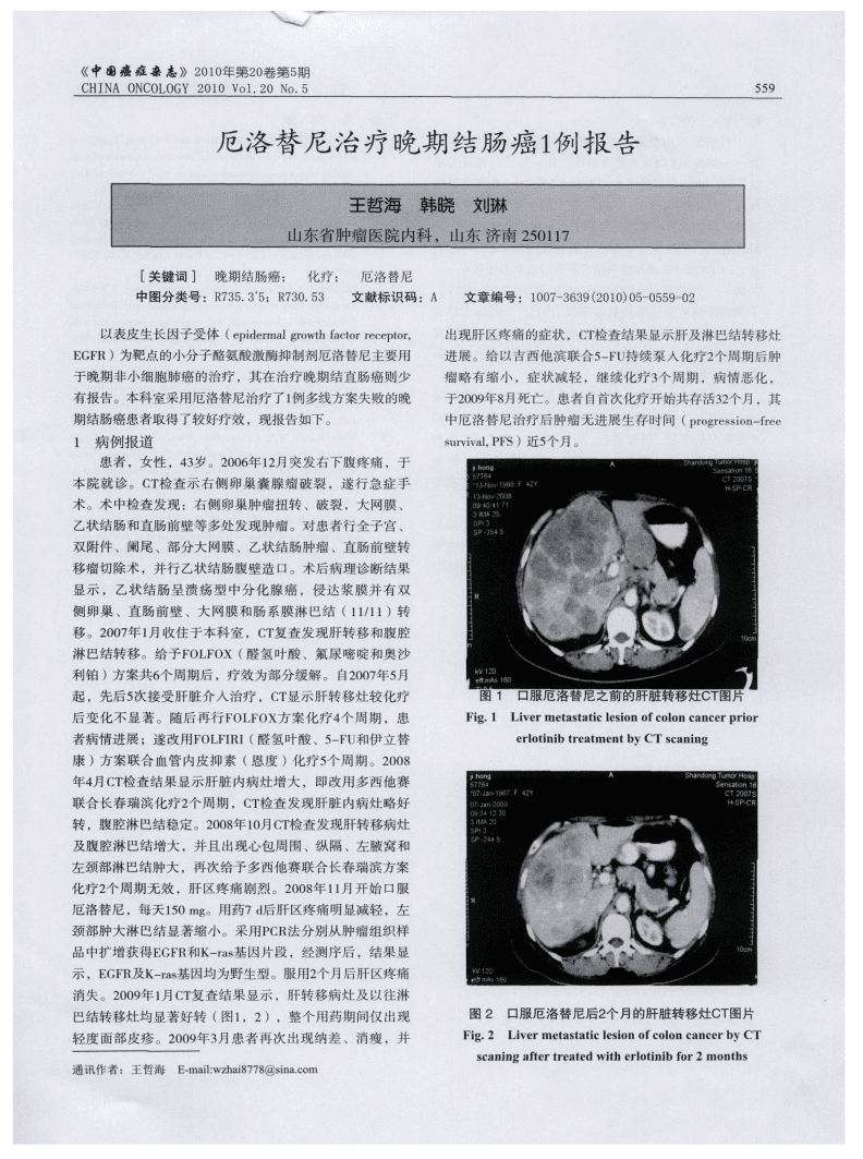 吉非替尼耐药性症状_克唑替尼平均耐药时间_拉帕替尼 一般多久耐药