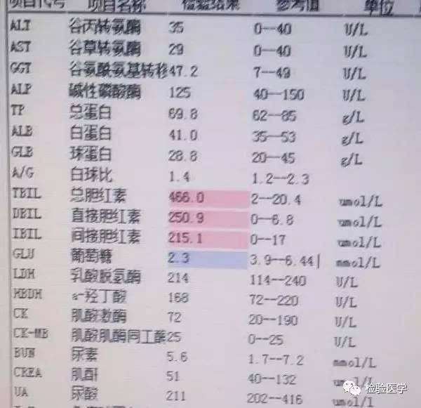 脚水肿吃什么_吉非替尼脚水肿_脚崴了水肿