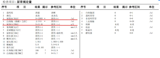 脚崴了水肿_吉非替尼脚水肿_脚水肿吃什么