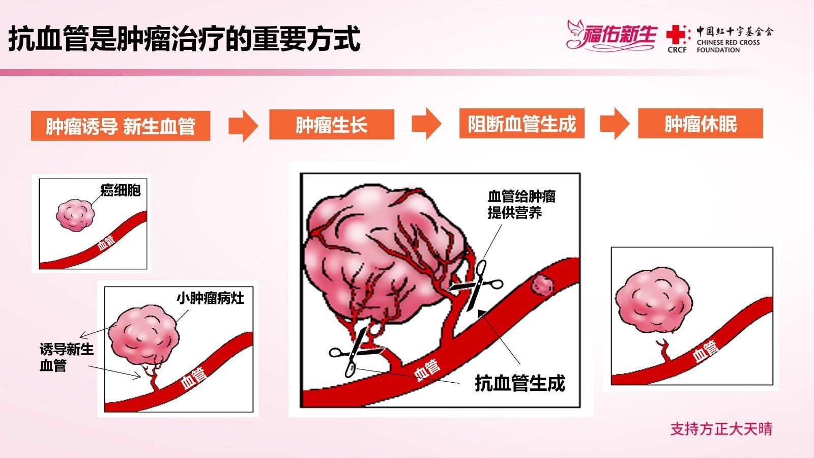 贝伐珠单抗赠药_贝伐珠单抗是什么药_胃癌靶向药贝伐单抗