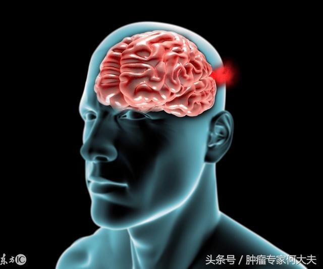 阿斯利康 奥希替尼_奥希替尼神奇的疗效_中国版奥希替尼