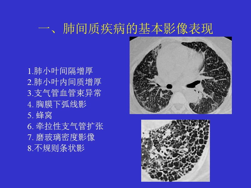 吉非替尼的抗肿瘤作用机制_肿瘤免疫治疗机制ppt_肿瘤发生的分子机制