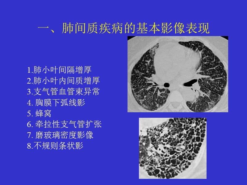 肆吉非替尼的临床表现及其处理方法-上海怡健医学科技