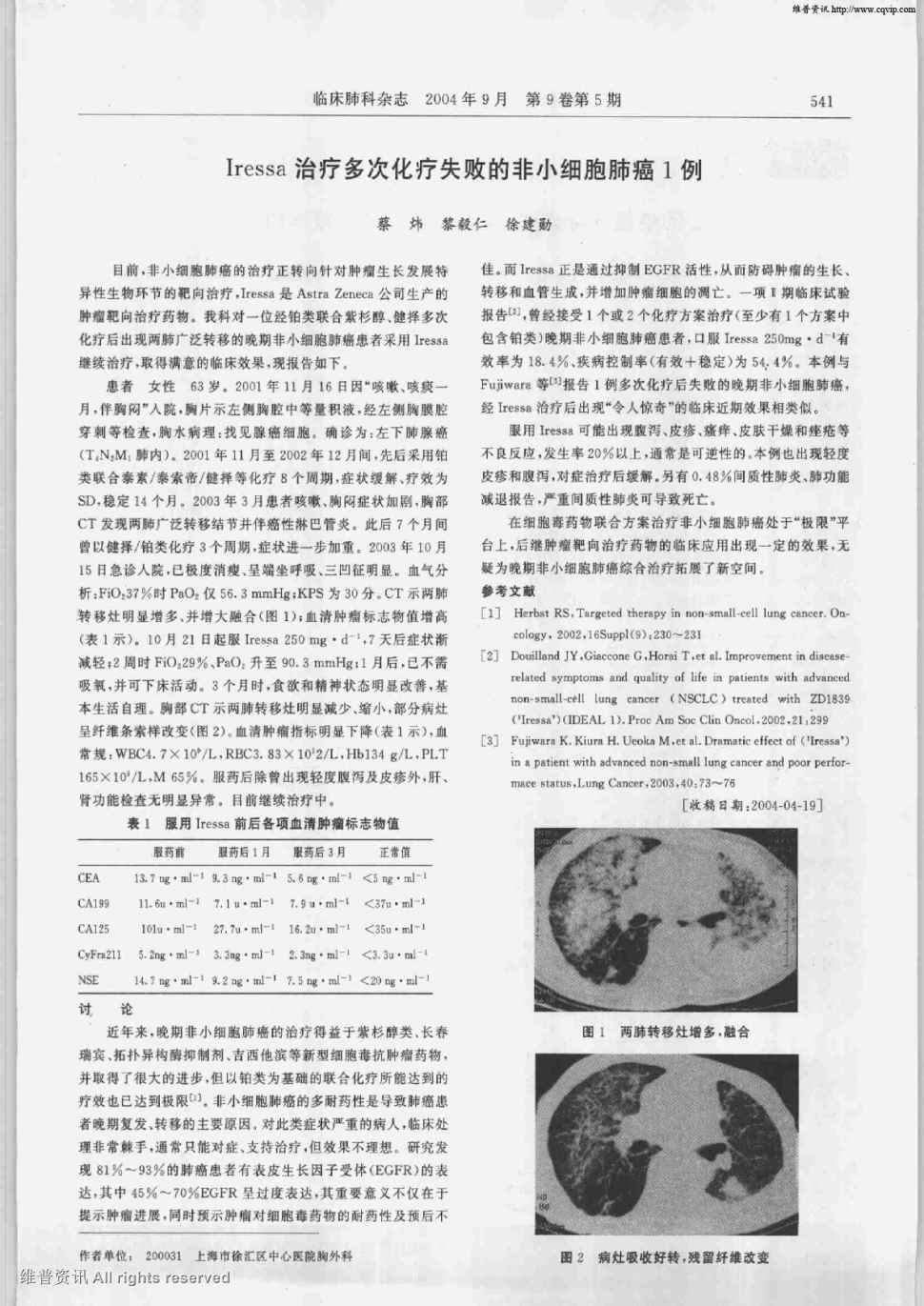 肺癌手术后可以贝伐单抗_贝伐珠单抗靶向是啥_肺癌新药贝伐单抗