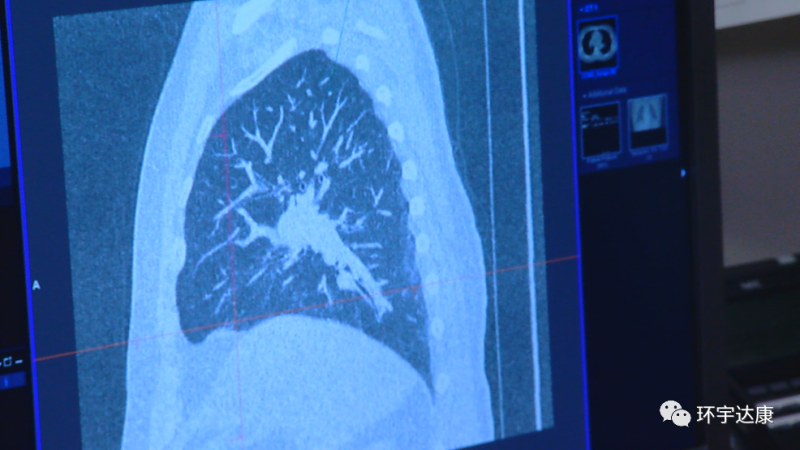易瑞沙可以使一些肺癌患者的肿瘤显著缩小，癌症症状明显缓解
