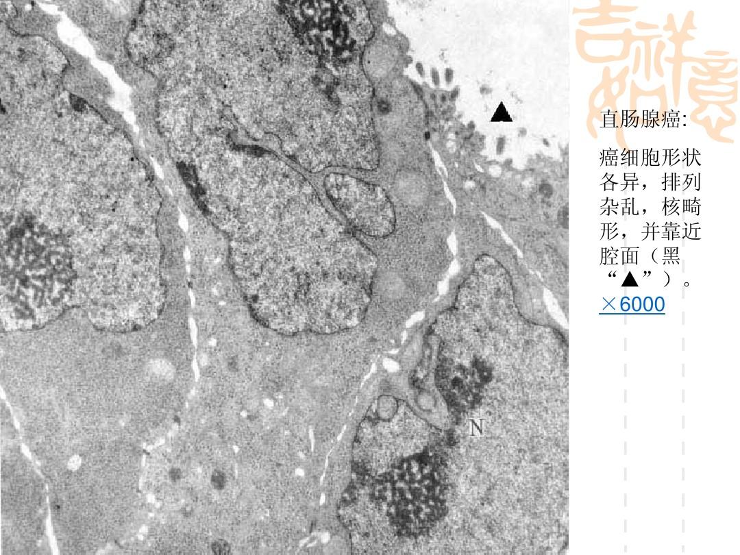 索拉非尼印度版 图片_索拉非尼要做基因检测么_做完放疗能用索拉非尼