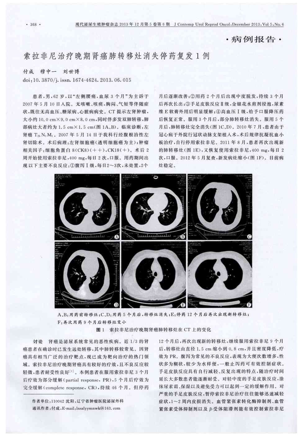 肺部原位腺癌手术后需要怎样治疗_子宫内膜腺癌治疗_吉非替尼治疗腺癌吗