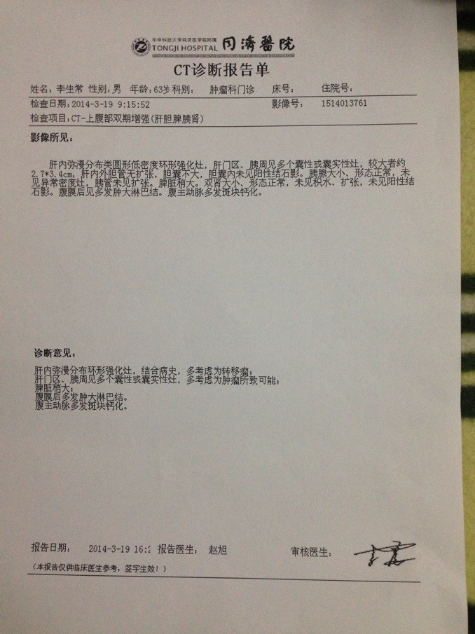 索拉非尼治肝癌用什么药_索拉非尼肝癌延长时间_pdone治癌症药肝癌