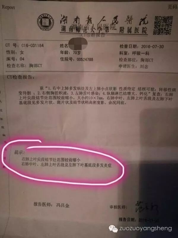 肺癌转移脑怎么治疗_肺癌转移脑全脑放疗有效果吗_肺癌脑转移副总奥希替尼无效