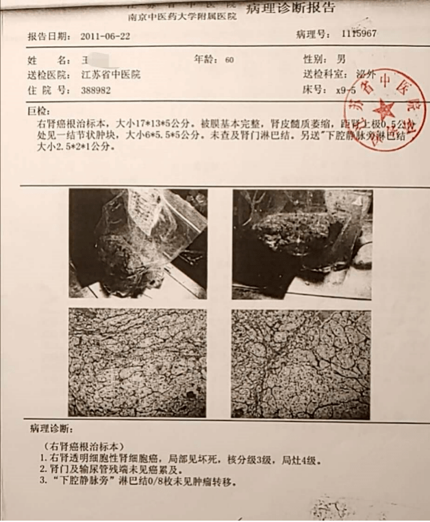 索拉非尼耐药后换索坦_索拉非尼停药后副作用_奥希替尼耐药后第四代靶向药