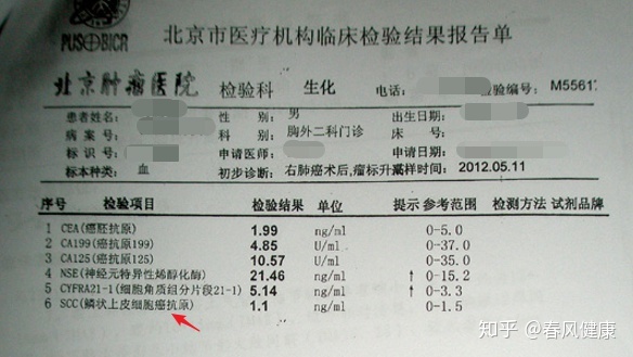 cea癌升高_cea癌胚抗原吉非替尼_癌抗原15一3偏高是癌吗