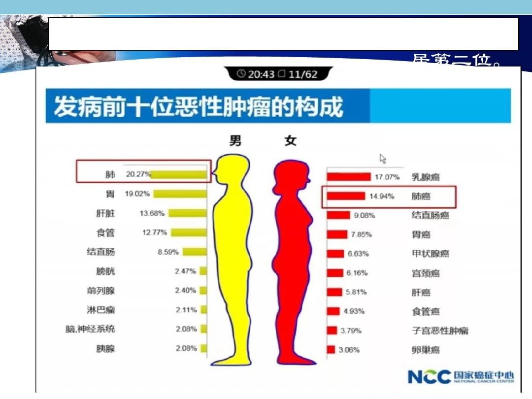 印度索拉非尼_印度版索拉非尼怎么买_印度抗肿瘤药物索拉非尼
