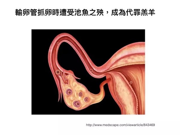 
贝伐单抗在欧洲获得一项新的适应症单抗卵巢癌单抗