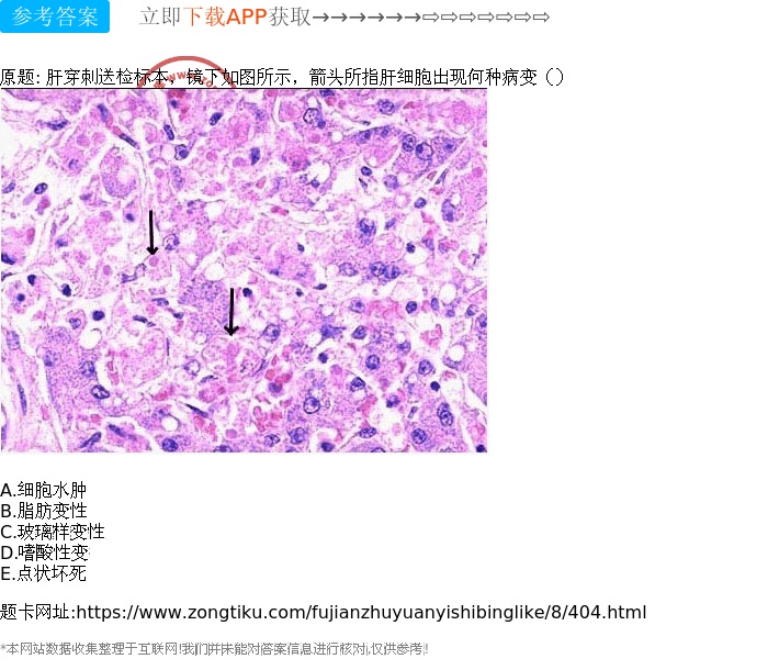 海外医疗告诉你，导致癌症复发的原因有哪些？